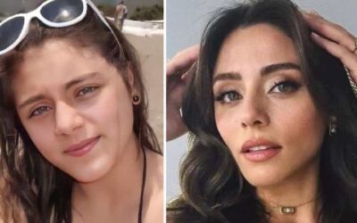 Stunning Transformation of Sıla Türkoğlu – No Cosmetic Secrets