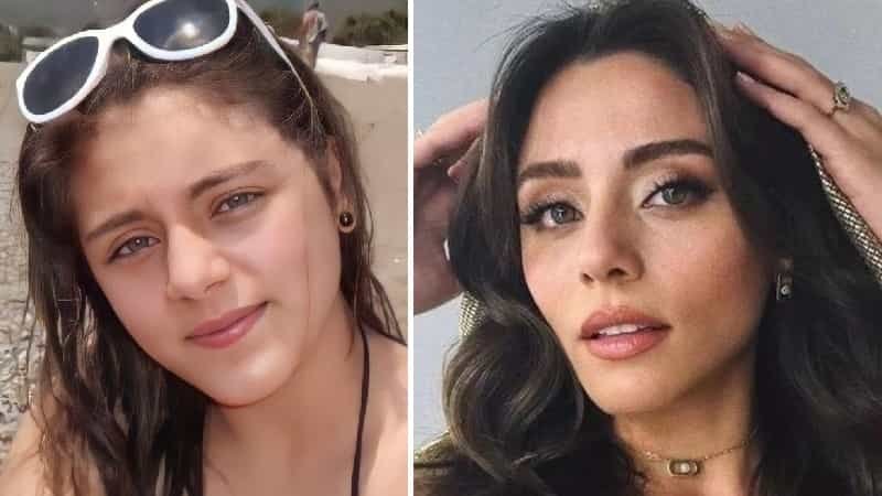 Stunning Transformation of Sıla Türkoğlu – No Cosmetic Secrets